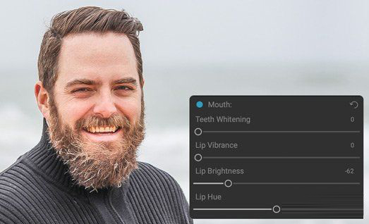 whiten-teeth-before.jpg